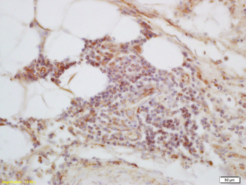 C1orf106 Rabbit Polyclonal Antibody