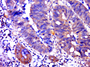 C1orf141 Rabbit Polyclonal Antibody