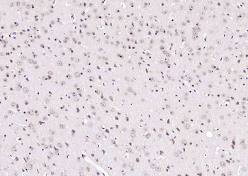 C1orf149 Rabbit Polyclonal Antibody