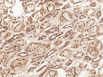 C1orf200 Rabbit Polyclonal Antibody