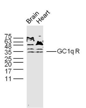 GC1q R Rabbit Polyclonal Antibody