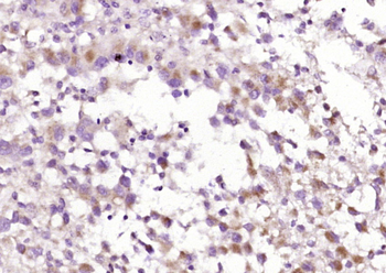 C1QC Rabbit Polyclonal Antibody
