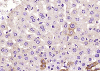 C1QC Rabbit Polyclonal Antibody