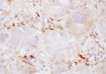 C1s Rabbit Polyclonal Antibody
