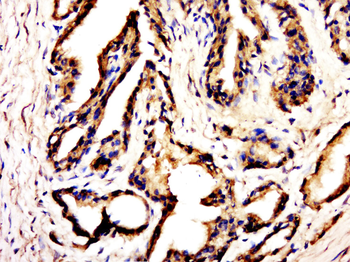 C20orf173 Rabbit Polyclonal Antibody