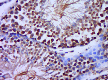 C20orf79 Rabbit Polyclonal Antibody