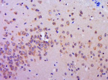 C20orf94 Rabbit Polyclonal Antibody