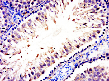 C21ORF13 Rabbit Polyclonal Antibody