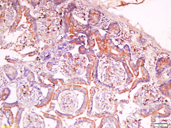 C2orf16 Rabbit Polyclonal Antibody