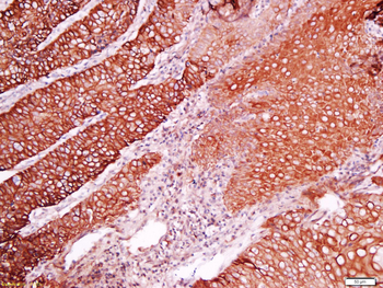C2orf16 Rabbit Polyclonal Antibody