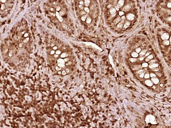 C3orf32 Rabbit Polyclonal Antibody