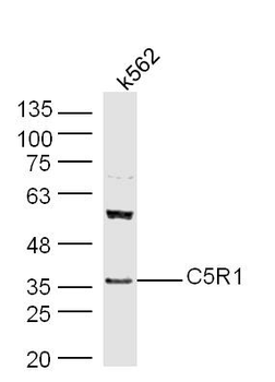 C5R1 Rabbit Polyclonal Antibody
