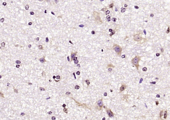 C7orf30 Rabbit Polyclonal Antibody