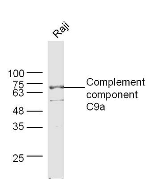 Complement component C9a Rabbit Polyclonal Antibody