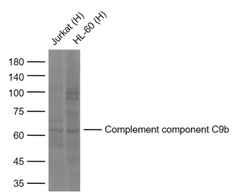 Complement component C9b Rabbit Polyclonal Antibody