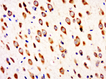 C9orf85 Rabbit Polyclonal Antibody