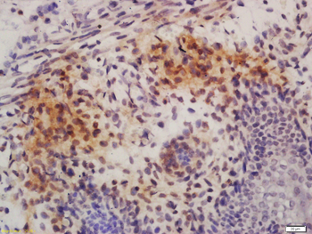 Phospho-c-ABL (Tyr245) Rabbit Polyclonal Antibody