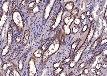 CACNA1G + CACNA1H Rabbit Polyclonal Antibody