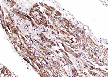 CACNA1G + CACNA1H Rabbit Polyclonal Antibody