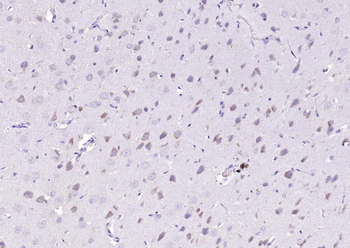 CACNA1G + CACNA1H Rabbit Polyclonal Antibody