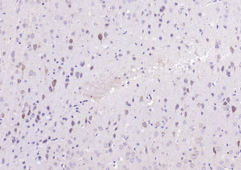 CACNA1G + CACNA1H Rabbit Polyclonal Antibody