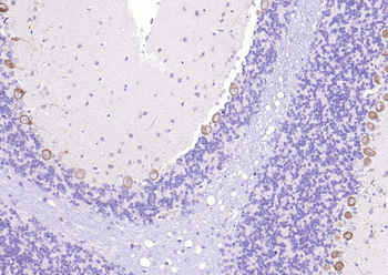 CACNA1G + CACNA1H Rabbit Polyclonal Antibody