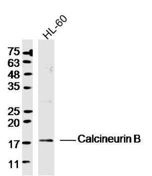 Calcineurin B Rabbit Polyclonal Antibody