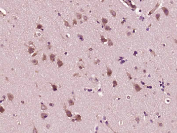 Calcyphosine 1 Rabbit Polyclonal Antibody