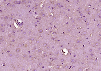 CaMKK1 Rabbit Polyclonal Antibody