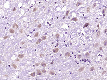 CAPRIN2 Rabbit Polyclonal Antibody