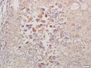 Caseine Kinase 1 alpha Rabbit Polyclonal Antibody