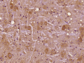 CASK Rabbit Polyclonal Antibody