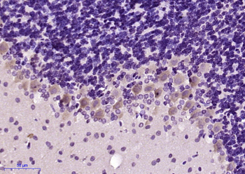 CBLN2 Rabbit Polyclonal Antibody