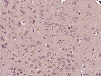 TCP1 beta Rabbit Polyclonal Antibody