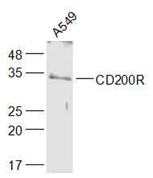 CD200R Rabbit Polyclonal Antibody