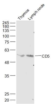 CD5 Rabbit Polyclonal Antibody