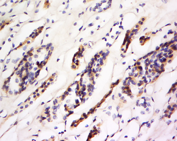 CD93 Rabbit Polyclonal Antibody