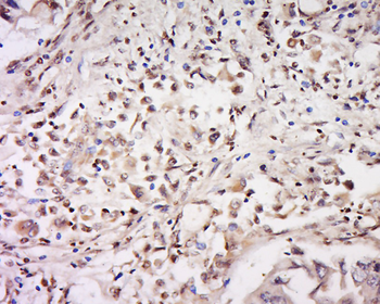 CD93 Rabbit Polyclonal Antibody