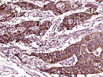 CDH23 Rabbit Polyclonal Antibody
