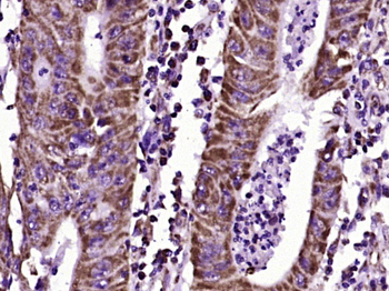 CEA Mouse Monoclonal Antibody