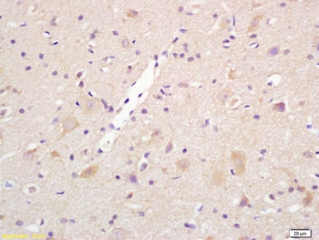 Centaurin alpha 1 Rabbit Polyclonal Antibody