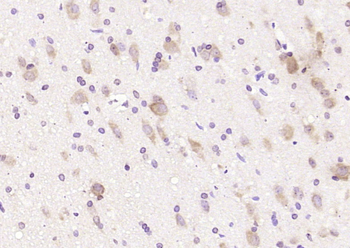 STUB1 Rabbit Polyclonal Antibody