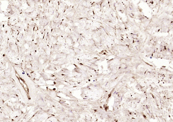 Phospho-CK II beta (Ser209) Rabbit Polyclonal Antibody
