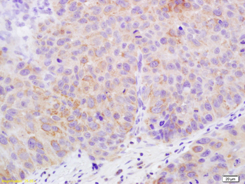 Claudin 17 Rabbit Polyclonal Antibody