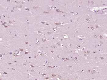 Complement C3d fragment Rabbit Polyclonal Antibody