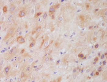 CSP Rabbit Polyclonal Antibody