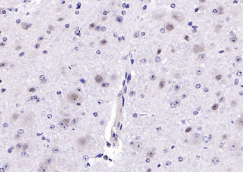 Ctip1 Rabbit Polyclonal Antibody