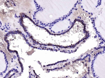Cux2 Rabbit Polyclonal Antibody