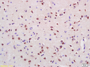 Cux2 Rabbit Polyclonal Antibody