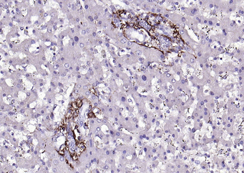 CYB5R3 Rabbit Polyclonal Antibody